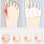 4x Coussinets en Silicone pour l'avant-pied - Alignement des orteils